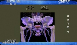 《健康之路》20150323视频和笔记:手臂骨折的正确固定 大小腿骨折的正确处理方法