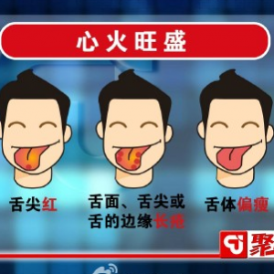聚健康20150326视频和笔记:《远离癌症怎么吃(9)》