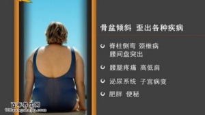 家政女皇20150331视频和笔记:骨盆倾斜的原因 骨盆矫正的运动方法