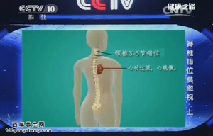 《健康之路》20150411视频笔记: 脊椎关节错位的表现 颈椎错位的症状 纠正脊椎错位的手法