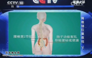 《健康之路》20150413视频笔记: 腰椎错位的纠正方法 仰卧定腿功 腰椎错位易诱发哪些问题