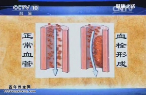 《健康之路》20150415视频笔记:服用抗生素的注意事项 白细胞与白血病的关系