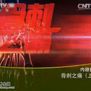 《健康之路》20150507视频笔记:骨刺的形成原因 哪些部位容易长骨刺