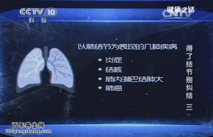 《健康之路》20150515视频和笔记:肺结节会变癌吗 肥胖与肺癌的关系 肺结节的治疗