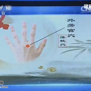 《健康之路》20150611视频笔记:艾灸器具缓解颈椎疼痛 湿针灸疗法 艾灸缓解扭伤的方法