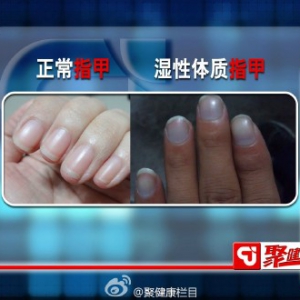 聚健康20150715:漆浩讲《“掌”握茶奥秘3》手诊辨别湿性体质