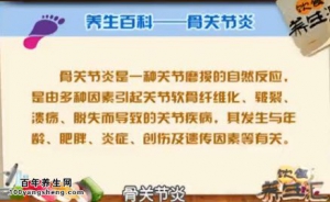 饮食养生汇20150716视频和笔记:什么是骨关节炎 骨性关节炎的诱因及预防