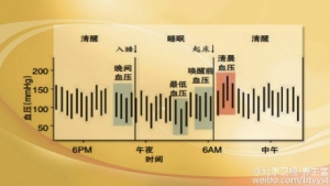 《养生堂》20150725视频笔记:《调压重在控“波动”-1》血压波动的误区