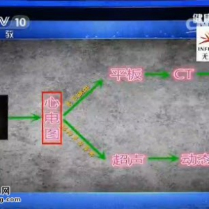 《健康之路》20150728视频和笔记:《救心路莫走错(上)》心绞痛的认知误区