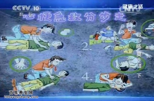 《健康之路》20150729视频和笔记:《救心路莫走错(下)》心梗病人急救指南