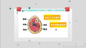 艾问常识201508019视频和笔记:纪小龙讲皮下鼓包的秘密 皮下鼓包遭遇误诊误治