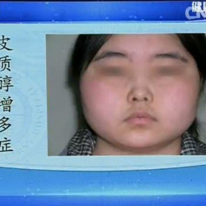 《健康之路》20150930:北京大学第一医院专家团讲察言观色辩健康（一）