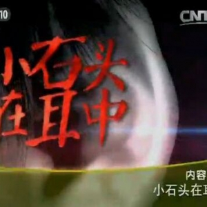 《健康之路》20151020:《小石头在耳中》耳石症患者的禁忌 如何确诊耳石症？