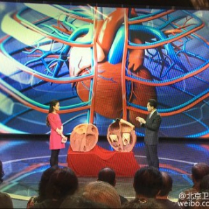 《养生堂》20151029视频笔记:刘兴鹏讲《抵御致命心颤》房颤高危因素 房颤的治疗