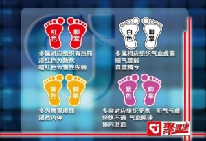 聚健康20151028:《你知足吗-2》通过脚掌知健康