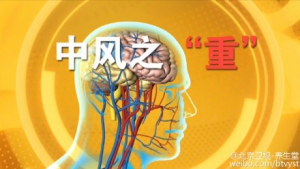 《养生堂》20151126视频笔记:《找到中风“元凶”》脑中风的高危因素与血管年龄测试