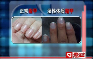 聚健康20151208视频笔记:漆浩讲《“掌”握茶奥秘3》