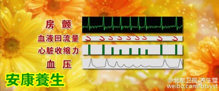 养生堂20151215视频笔记:董建增《消除心内“无声伤害”》如何预防及消除房颤