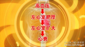 《养生堂》20160126视频笔记:高血压的类型与心衰的关系、主动脉夹层的典型表现