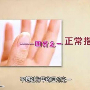 饮食养生汇20160127:韦云讲通过指甲形状看健康、泡手方、藏在指甲里的秘密
