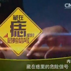 《健康之路》20160128笔记:曹梅讲除痣用哪种方法最科学？