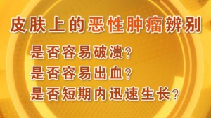 《养生堂》20160205视频笔记:《皮肤老化需防癌》脂溢性角化症、日光性角化症
