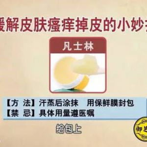 饮食养生汇20160205笔记:银屑病会传染吗？如何缓解皮肤瘙痒、银屑病会导致哪些疾病？