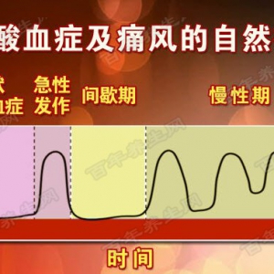 《养生堂》20160206视频和笔记:曾学军讲高尿酸血症的高危人群及调理