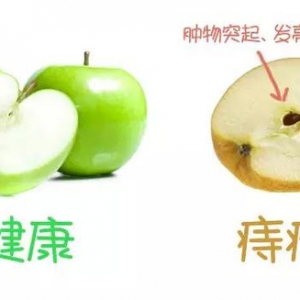 “肛门痛”能随便用痔疮药吗？