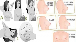 怎样远离乳腺癌？远离乳腺癌到底要怎样做呢？