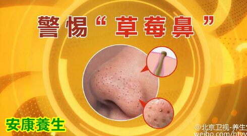 胃癌的四大症状