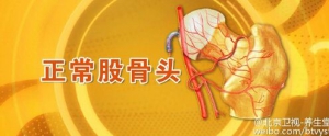 《养生堂》20160323视频笔记:股骨头坏死的三大危险因素、股骨头坏死的三大危机