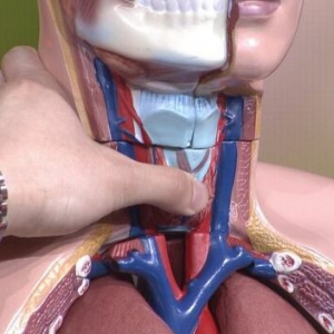 《养生堂》20160403笔记:甲状腺癌的表现、甲状腺癌和饮食的关系、判断结节是良性还是恶性