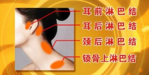 《养生堂》20160415笔记:良性淋巴肿大和淋巴瘤的区分、病毒引发的癌症、乙肝病毒、HPV病毒