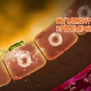《养生堂》20160418笔记:幽门螺杆菌的危害、胃癌与幽门螺杆菌的关系、养胃你做对了吗？