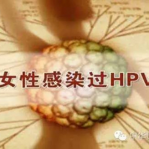 HPV认知误区和宫颈癌的高危人群