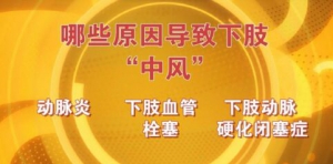 《养生堂》20160503:下肢动脉硬化闭塞症、动脉炎、急性下肢栓塞、血管性跛行、神经性跛行
