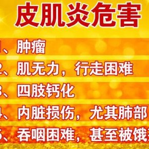 北京卫视20160519《养生堂》视频:王国春、皮疹、癌症、炎性肌病、皮肌炎的症状与危害