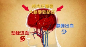 北京卫视20160723《养生堂》吉训明、高同型半胱氨酸血症、易栓体质、脑鸣、耳鸣