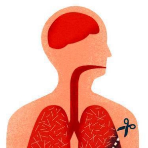 肺癌离我们有多远？