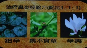 《健康之路》20160726:治疗鼻炎经验方、缓解鼻炎保健操、揿针治鼻炎、补肺化瘀开窍经验方