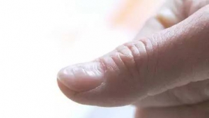 肝脏有毒素的4大表现