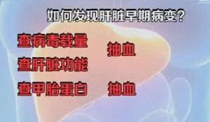 《健康之路》20160728视频笔记:董家鸿、乙肝、肝癌、如何发现肝脏早期病变？
