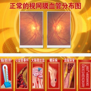 北京卫视20160801《养生堂》全身动脉硬化、小血管病变、明目延年方、一过性黑矇、暴盲