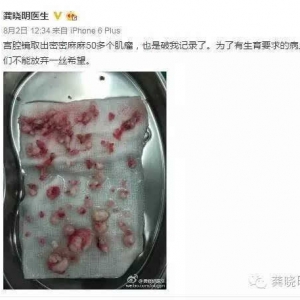 宫腔镜冷刀切除子宫肌瘤有什么优势？