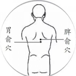 拔罐有哪些功效？湿气重有哪些表现？