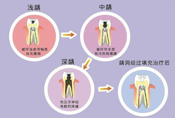 表示原因的图片图片