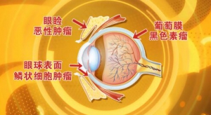 北京卫视20160817《养生堂》王艳玲、眼底黄斑变性、视网膜黄斑变性