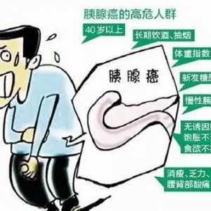 警惕：腹痛不一定是胃病，也可能是胰腺癌