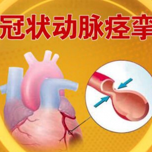 北京卫视20160925《养生堂》、冠状动脉痉挛、无症状型冠心病